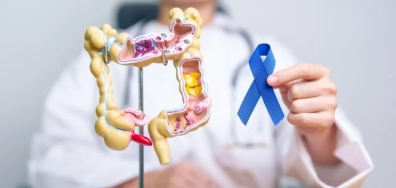 Mortes por câncer colorretal podem quase triplicar no Brasil até 2030, aponta pesquisa