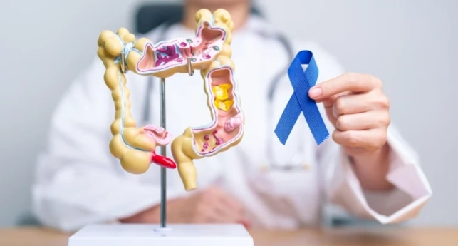 Mortes por câncer colorretal podem quase triplicar no Brasil até 2030, aponta pesquisa